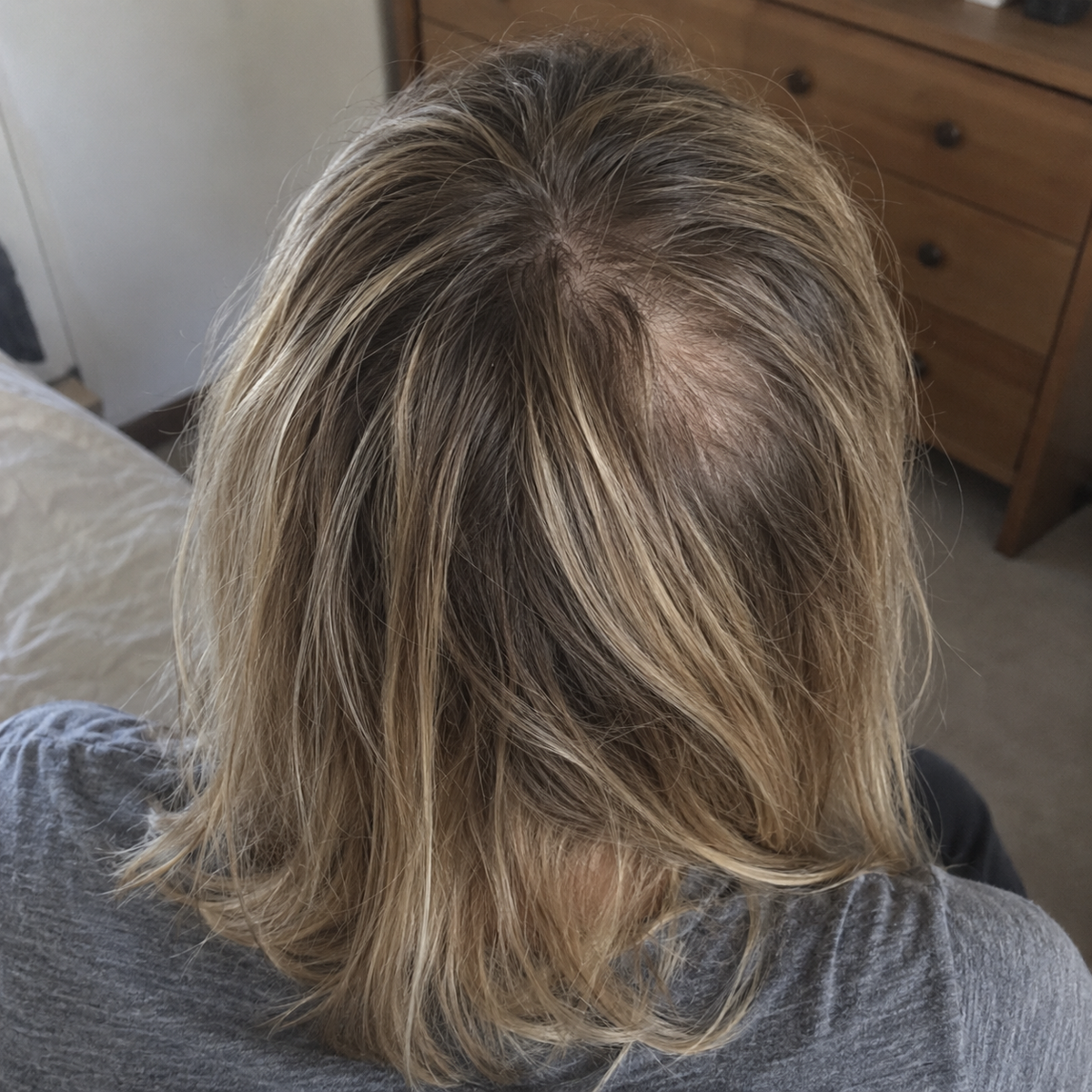 Crown — Before