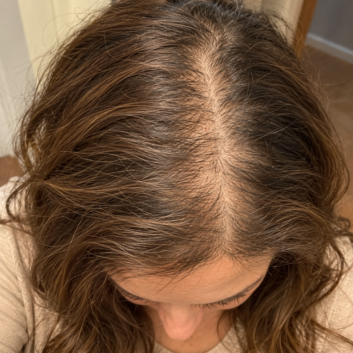 Part line — Before