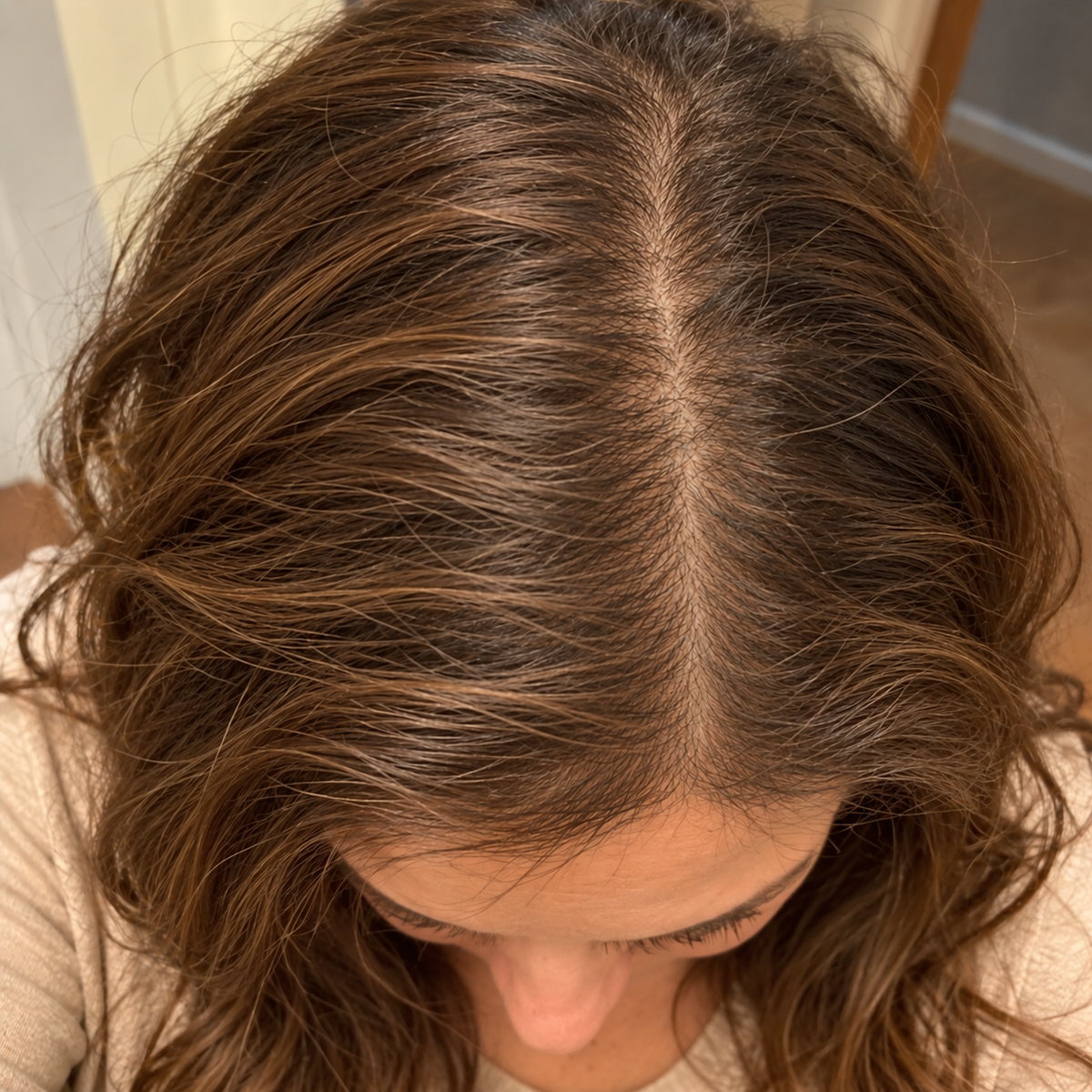 Part line — After